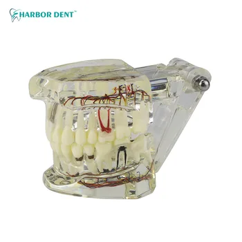 Dentare Ortodontice Dinți Model Cu Bretele Archwire Guma Dinte Rășină Stomatologie Materiale Pentru Studierea Predare Educatia Pacientului